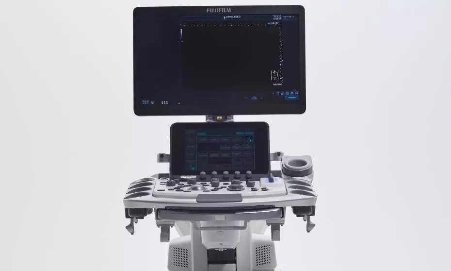 FUJIFILM India Launches ARIETTA 850 Diagnostic Ultrasound System at Yashoda Hospital, Hyderabad