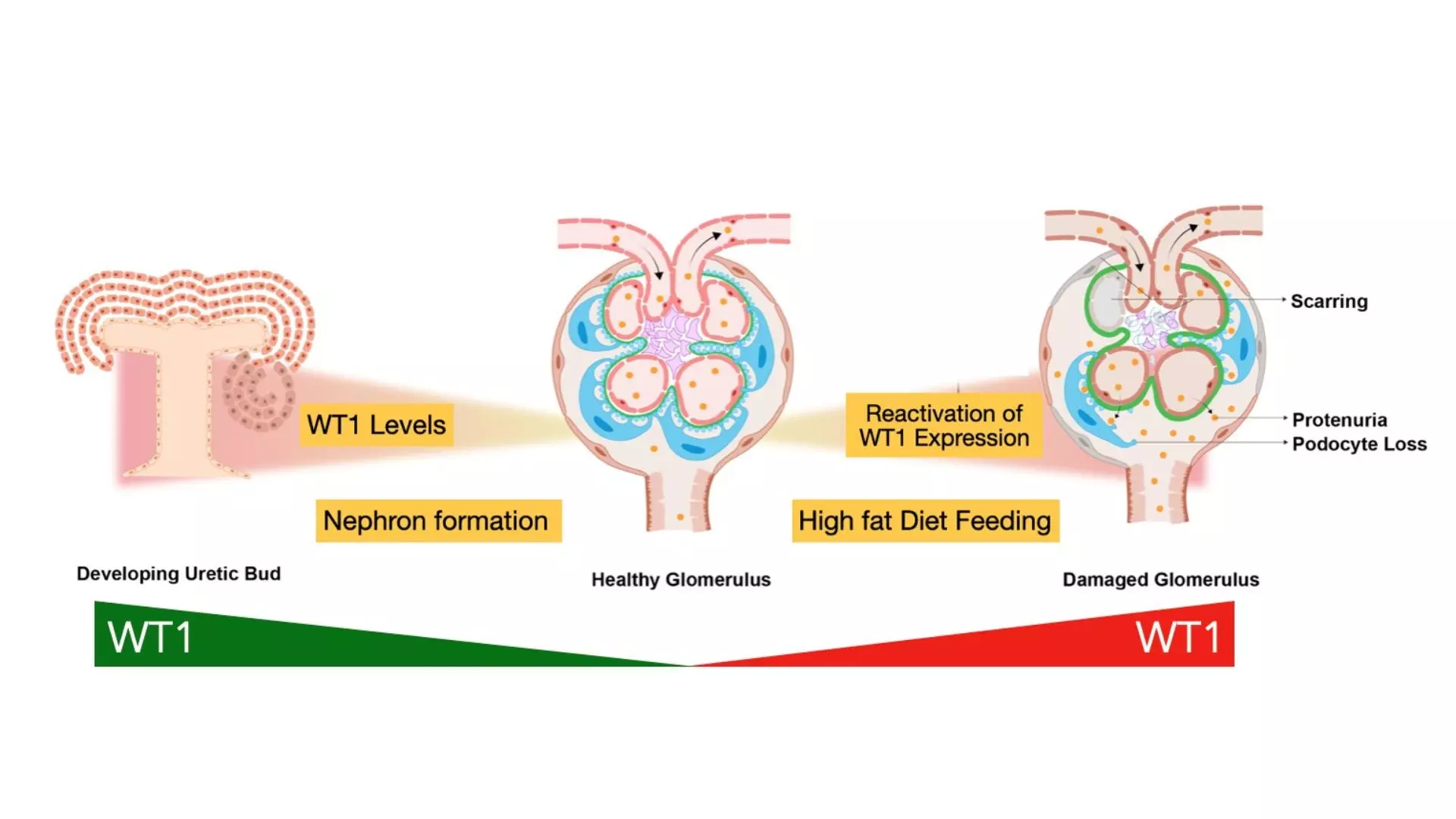 Hyderabad Researchers Uncover Link Between Obesity and Kidney Disease