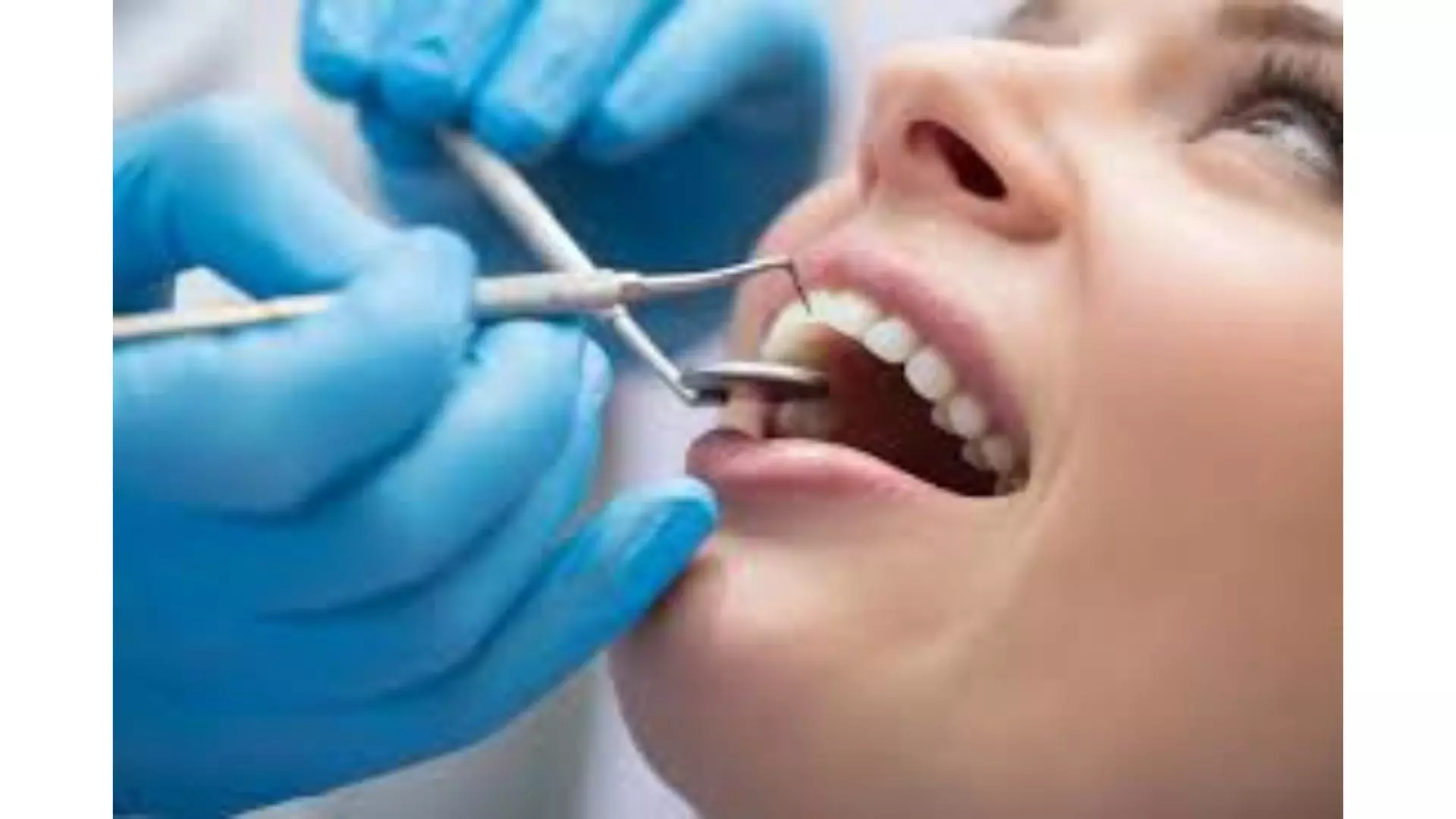 Delay in Telangana dental services counselling costs students seats