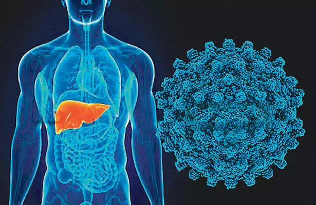 Hepatitis is on the rise in Telangana: Experts