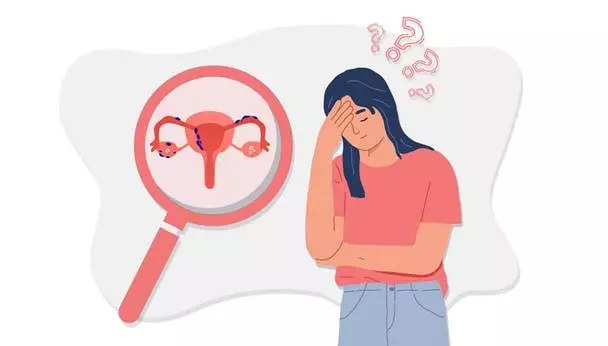 Endometriosis causes Infertility up to 50 pc among Women!