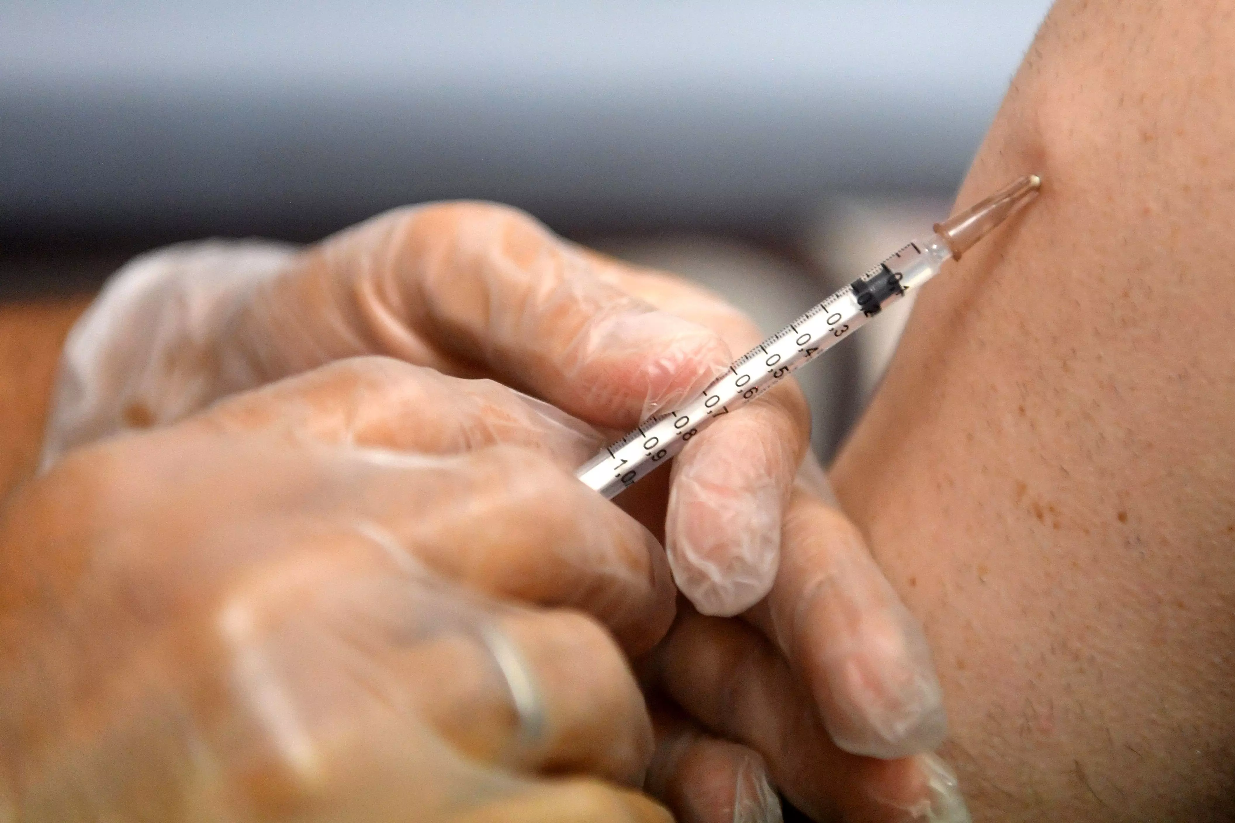 India to Issue Mpox Screening Guidelines for International Arrivals