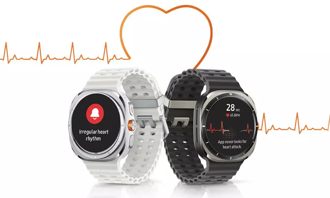 Samsung Rolls Out Irregular Heart Rhythm Notification Feature for Galaxy Watch Users in India