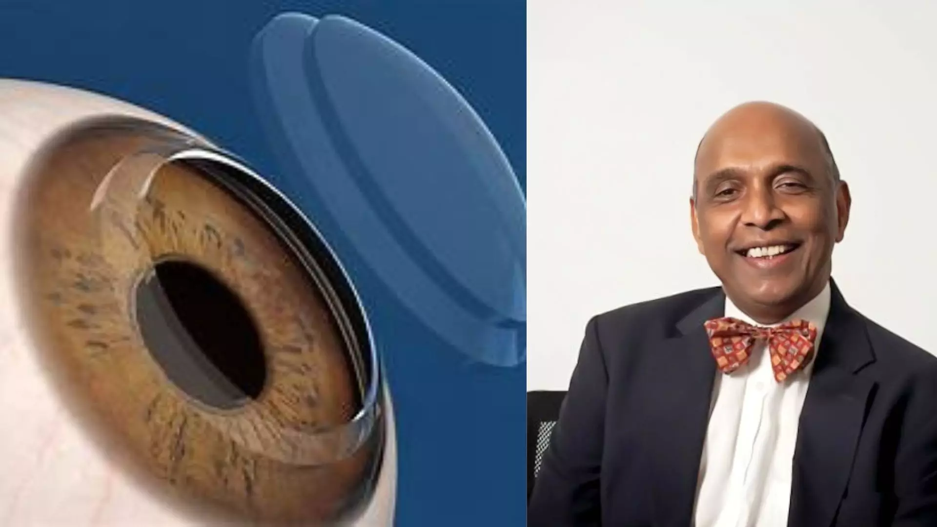 LV Prasad Eye Institutes 50,000 Corneal Transplant Milestone