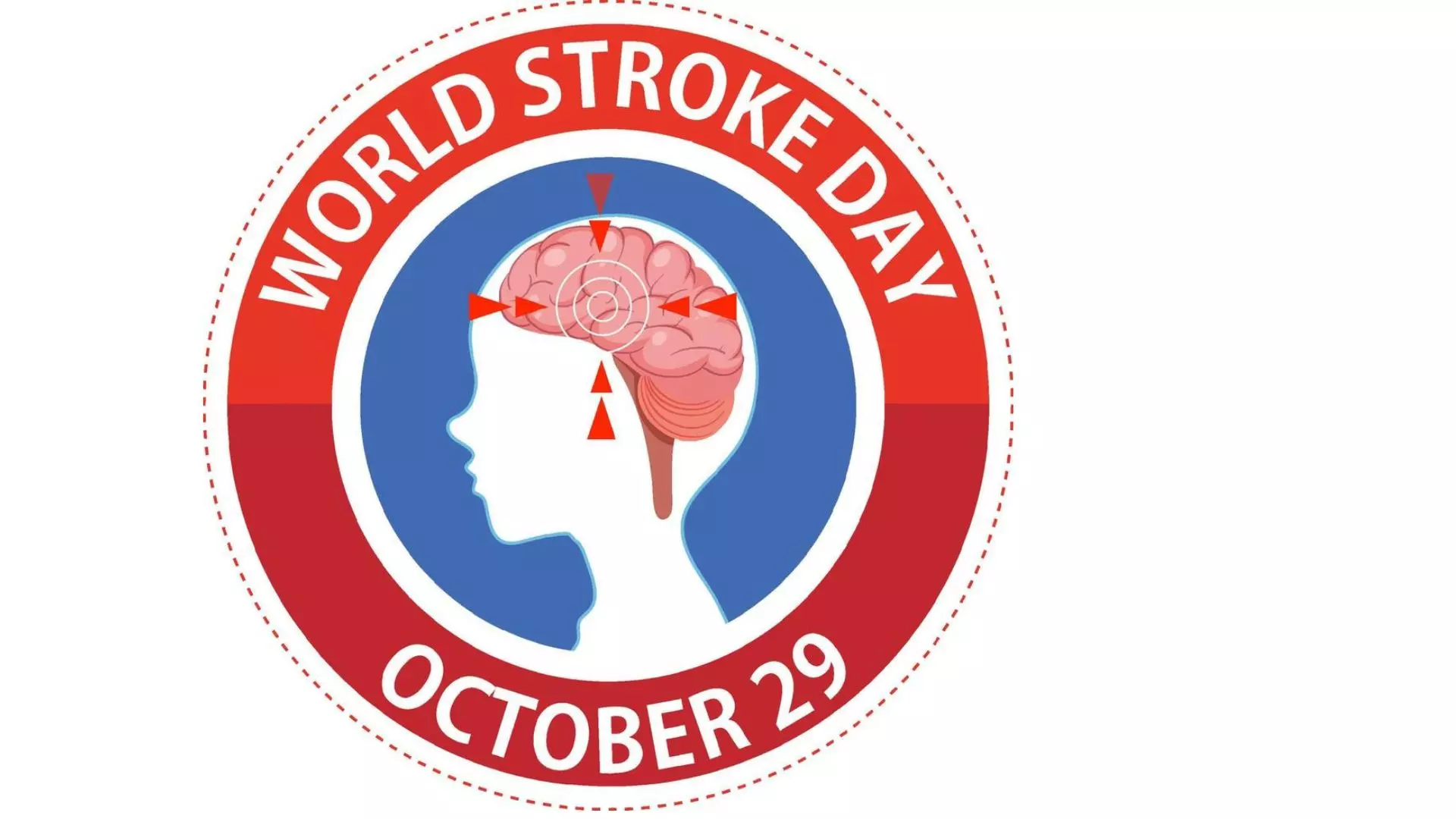 One in four affected by stroke globally: Expert