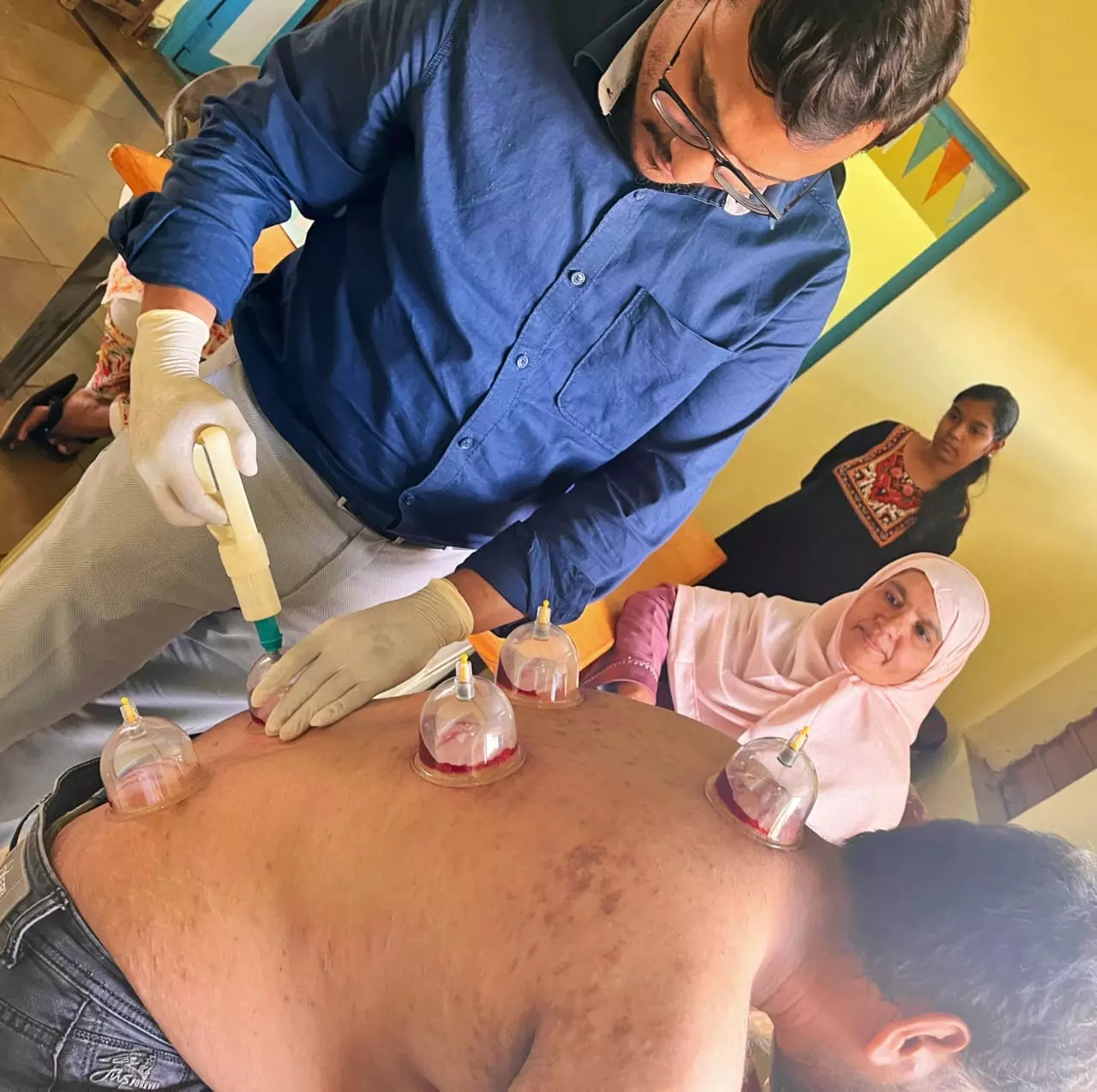 Ancient Cupping Therapy Gains Popularity for Chronic Pain Relief in Bidar