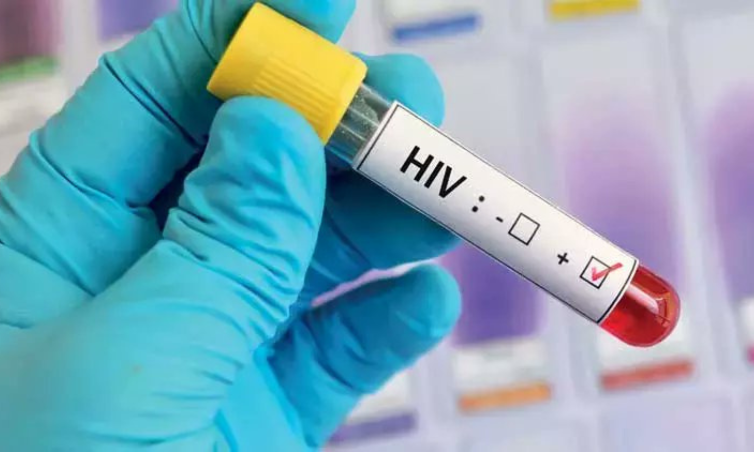 Effective HIV Prevention Methods Everyone Should Know