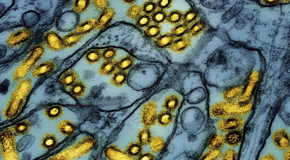 First severe bird flu case in U.S. reported in Louisiana, according to health officials